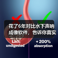 花了6年对比水下声呐成像软件,告诉你真实答案(图3) 花了6年对比水下声呐成像软件,告诉你真实答案(图3)